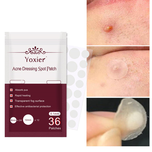 Skin Care Tools Acne Dressing Spot Patch Blemish Treatment Invisible Acne Stickers Pimple Remover Set Face Cream - ViroxaStore