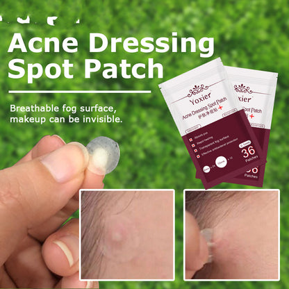 Skin Care Tools Acne Dressing Spot Patch Blemish Treatment Invisible Acne Stickers Pimple Remover Set Face Cream - ViroxaStore