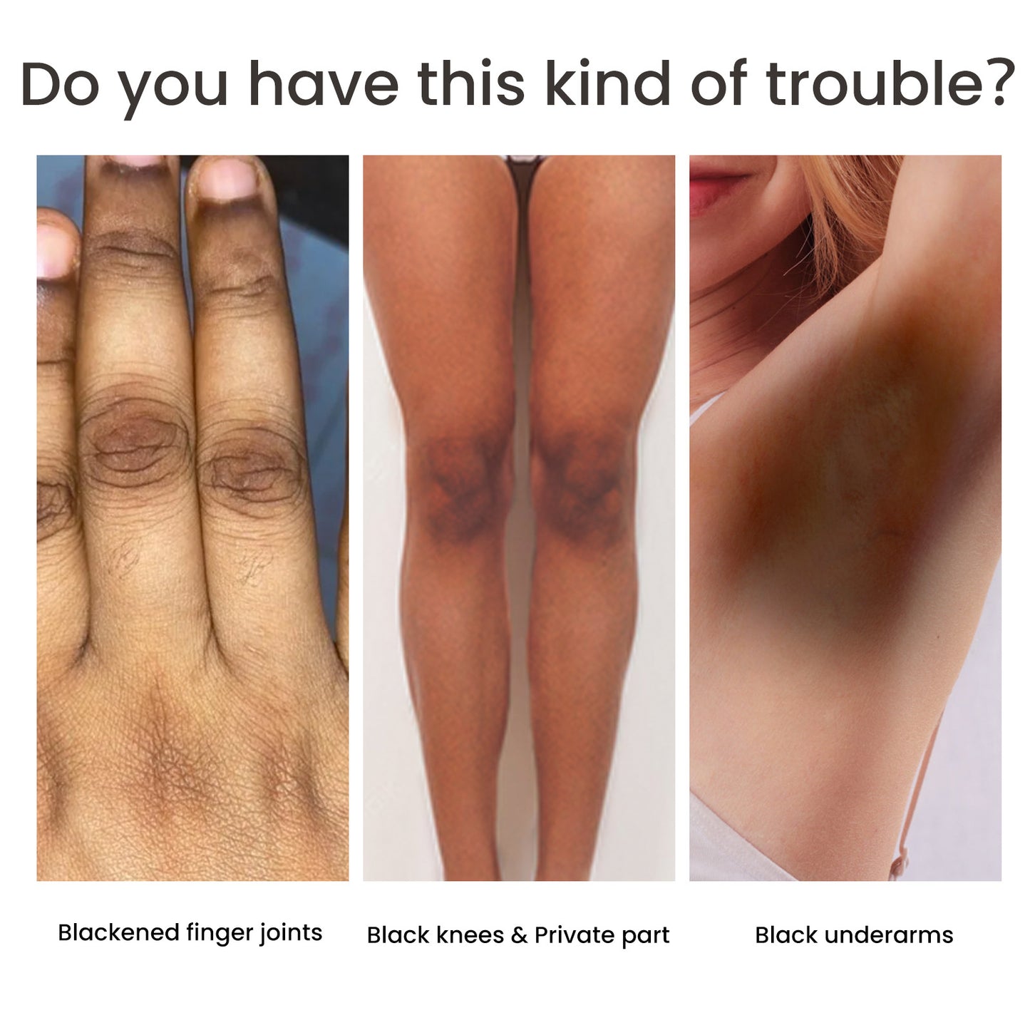 Women's Skin Pigmentation Care - ViroxaStore