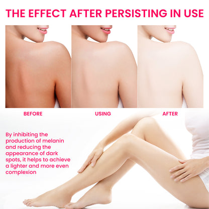 Women's Skin Pigmentation Care - ViroxaStore